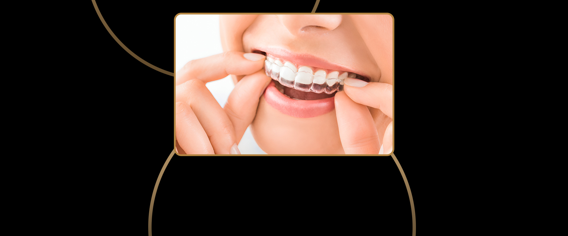 Invisalign for Spaced Teeth